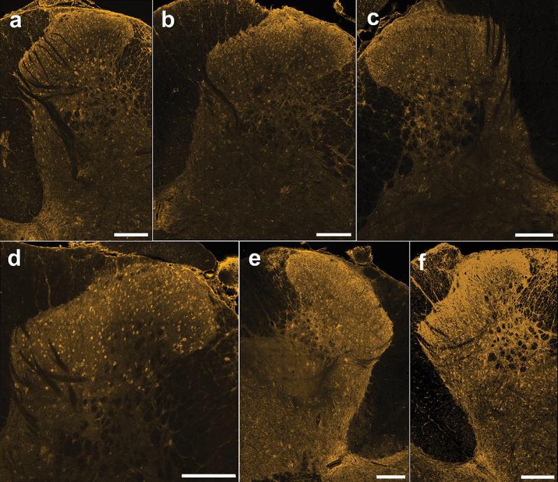 Immunoreactivity of the CB1 receptor in lumbar spinal cord sections from male rats. (A)–(F) Representative confocal images (20× objective) of CB1 immunostaining from each male rat (n = 6) showing neuropil staining that is especially pronounced in the SDH and cellular staining across the DH. Scale bar = 200 µm.
