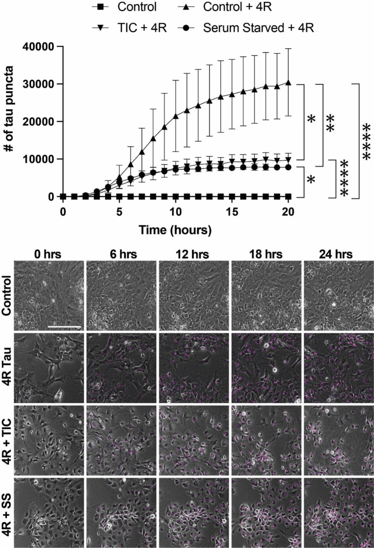 Nutritional or inflammatory stress impairs astrocyte tau uptake. hESC-derived astrocytes exposed to labeled 4R tau with or without serum starvation (SS) or TIC protocol (TNFα, IL1-α, C1q) with representative still images. N = 3 technical replicates per condition; *p = 0.0015, **p = 0.0005, ***p = 0.0001, ****p < 10 − 5