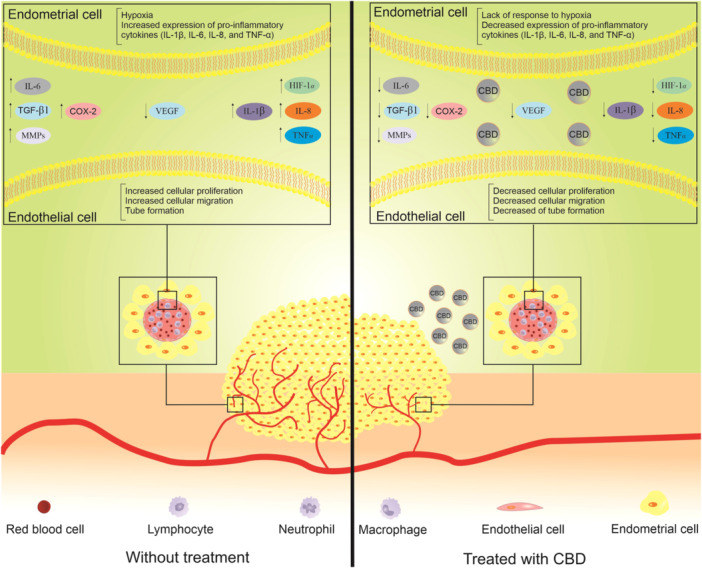 This figure shows which molecules are involved in the pathogenesis of endometriosis which could be targeted by cannabidiol. The left side is the endometriosis condition without treatment and the right side is the same situation with treatment of cannabidiol. The treatment could reduce the number of endometrial cells via inhibition of angiogenesis and inflammation. CBD, cannabidiol; HIF‐1α, hypoxia‐inducible factor 1α; IL, interleukin; MMP, matrix metalloproteinase; TGF‐β, transforming growth factor β; TNF‐α, tumor necrosis factor‐α; VEGF, vascular endothelial growth factor.