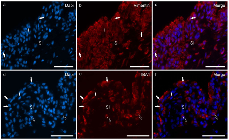 Photomicrographs of cryosections of the synovial membrane of the stifle joints of dogs showing immunoreactivity for the fibroblast marker vimentin (b) and the macrophage marker IBA1 (e). (a–c) The synovial membrane of the stifle joint showed different layers of synoviocytes (arrows) which expressed moderate-to-bright vimentin immunoreactivity (b). (d–f) Three macrophage-like synoviocytes lining the joint cavity, expressing bright IBA1 immunoreactivity, are indicated by the white arrows (e). The subintimal macrophages (open arrows) also expressed IBA1 immunoreactivity. Abbreviations: I, intima; SI, subintima. Bar: 50 µm.