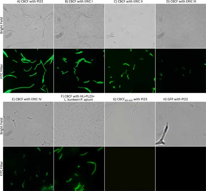 Fluorescence microscopy of the different P. larvae cells decorated with the GFP-CBCF. The different P. larvae ERIC genotypes were incubated with the fusion protein GFP-CBCF, GFP-CBCF403–645 (truncated CBCF fragment from nucleotide 403 to 645) or GFP only, and observed at the fluorescence microscope to assess the specificity of their binding ability to these bacterial cells: (A) GFP-CBCF with P. larvae Pl02-23 (the phage host) that belongs to ERIC I; (B) GFP-CBCF with another P. larvae ERIC I; (C) GFP-CBCF with P. larvae ERIC II; (D) GFP-CBCF with P. larvae ERIC III; (E) GFP-CBCF with P. larvae ERIC IV; (F) GFP-CBCF with homogenised larvae (HL) artificially contaminated with P. larvae Pl02-23, Lactobacillus kunkeei (LMG 18925) and Parasaccharibacter apium alpha 2.2; (G) GFP-CBCF403–645 with P. larvae Pl02-23; (H) GFP with P. larvae Pl02-23. Observations were made in bright field and under FITC to detect the presence of non-decorated cells. White bar scale represents 10 µm.