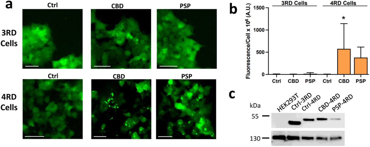 (a) Representative images of Tau4RD*LM–YFP cells and Tau3RD*VM-YFP cells infected with CBD and PSP patient samples. YFP is shown in green. (Scale bar, 50 µm). (b) Quantification of cell infection. * = P < 0.05. (c) Lysates collected in RIPA buffer from naïve HEK293T cells, Tau3RD*VM-YFP cells, Tau4RD*LM-YFP cells, and Tau4RD*LM-YFP cells stably infected with CBD or PSP tau prions were analyzed for the presence of the tau-YFP fusion protein by Western blot using the GFP primary antibody (top blot). Vinculin (bottom blot) is shown as a loading control. Full uncropped gel is shown in Fig. S1.
