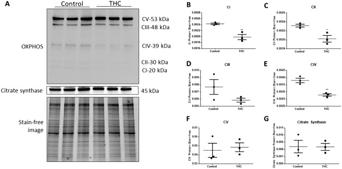 THC reduces levels of mitochondrial complex proteins without altering citrate synthase protein expression. (A) Western blot images (20 µg) of mitochondrial OXPHOS respiratory complex protein levels, citrate synthase and stain-free image in control and 20 µM THC-treated conditions after 48 h. A cocktail antibody comprising the following subunits of respiratory complex proteins was used: NADH dehydrogenase (ubiquinone) 1 beta subcomplex 8 (NDUFB8; complex I), succinate dehydrogenase complex, subunit B (SDHB; complex II), ubiquinol-cytochrome c reductase core protein II (UQCR2; complex III), cytochrome c oxidase subunit 2 (COXII; complex IV) and ATP synthase 5A (ATP 5A, Complex V). Quantification of the levels of each of the above-mentioned subunits and CS expression are shown, respectively (B–G) The individual points represent the ratios of proteins normalized to stain-free image (n = 3), the horizontal lines represent the means and the error bars represent SEM. Significant differences were determined by Student’s t-test. **P < 0.01 (B,E); *P < 0.05 (C); P = ns (D,F,G).