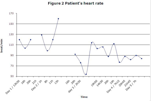 Patient’s heart rate.