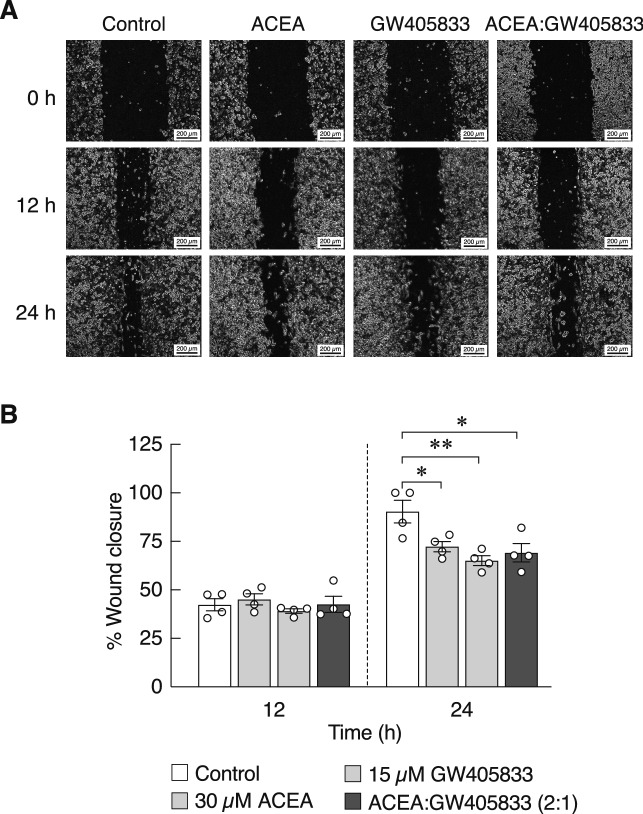 Combining effect of ACEA and GW405833 at ratio of 2:1 on MDA-MB-231 cell migration. (a) Representative images illustrated the migration of MDA-MB-231 cells treated with the indicated concentrations of each compound or the combination for 12 and 24 h. Cell migration was assessed by wound healing assay. (b) Quantified data is represented as mean ± SEM of two independent biological experiments with two technical duplicates each. (**p < 0.01, *p < 0.05).