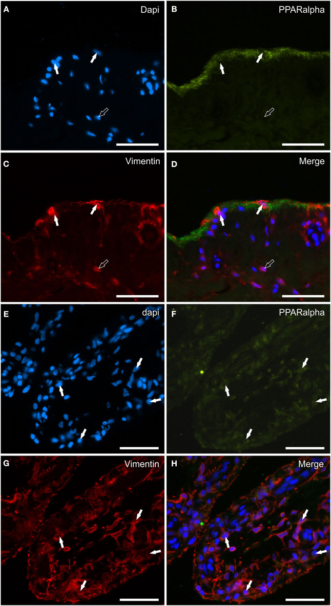 Photomicrographs of the cryosections of the synovial membrane of a horse metacarpophalangeal joint showing peroxisome proliferator-activated receptor alpha (PPARα) immunoreactivity in synoviocytes (A–H). (A–C) The white arrows indicate the DAPI (Blue) labeled nuclei of synoviocytes brightly immunolabelled with the anti-vimentin (Red) antibody which expressed faint-to-moderate PPARα (Green) immunoreactivity. It is possible to see the indistinct PPARα immunostaining of the upper portions of the cells lining the joint cavity. (E–H) The figures show the longitudinal sections of two villi of the synovial membrane in which the arrows indicate the DAPI (Blue) labeled nuclei (E) of the cells, likely fibroblast-like synoviocytes and fibroblasts, co-expressing faint-to-moderate PPARα-(Green) (F) and bright vimentin-(Red) (G) immunoreactivity. (D, H) Merged images (Orange). Scale bar = 50 μm.