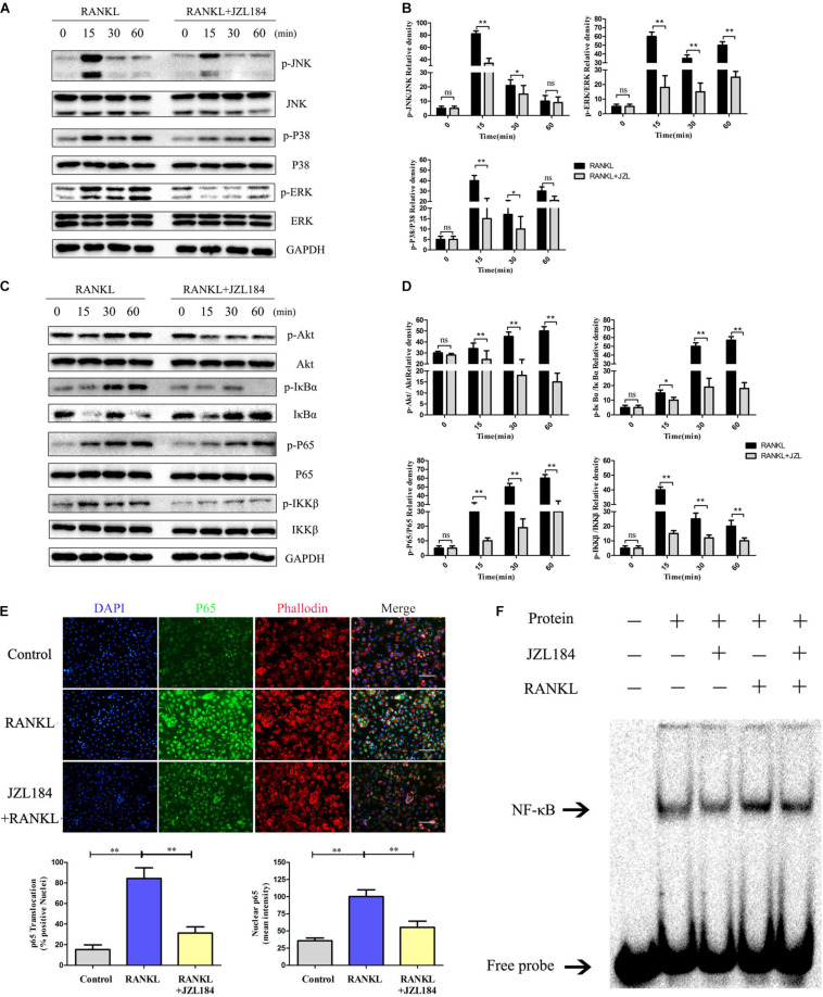 JZL184 represses RANKL-induced activation of the NF-κB and MAPK pathways. BMMs were cultured with α-MEM in the absence of FBS and pretreated with JZL184 (20 μM) or vehicle for 12 h. The BMMs were stimulated with or without RANKL (75 ng/mL) for the indicated times. (A,B) Total cell lysates were analyzed for cellular levels of p38, JNK, and ERK by Western blot analysis (left). (C,D) Total cell lysates were analyzed for levels of p65, IKKα/β, Akt, and IκBα by Western blot analysis (left). Right panel, densitometric analysis results from three independent experiments (right). Data are presented as means ± SD of three independent experiments. *P < 0.05 and **P < 0.01 vs. the vehicle. ns, not significant. (E) BMMs were pretreated with JZL184 (20 μM) for 12 h and then stimulated with RANKL for 30 min. Representative fluorescence micrographs of RANKL-induced translocation of p65 after JZL184 treatment are shown. (F) BMMs were pretreated with vehicle or 20 μM JZL184 for 24 h and stimulated with RANKL for 30 min. The nuclear proteins were prepared to evaluate binding of NF-κB to DNA by EMSA. Data are presented as means ± SD of three independent experiments. *P < 0.05 and **P < 0.01 vs. the vehicle or day 0.