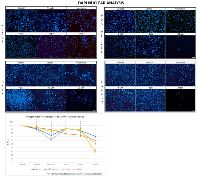DAPI fluorescence in HaCaT, HeLa, MDA-MB-231, and CaCo-2 cell lines treated for 24 h with different concentrations of CBD and controls. Treatments included 5, 10, and 20 μM of CBD, 1 μM of vincristine (positive control), methanol (vehicle), and culture medium (control). Scale bar: 50 μm. The graph shows the % area as a function of the concentrations of CBD and controls. It can be seen that CBD has a greater cytotoxic effect on the tumor cell lines at 24 h mainly at 20 µm. The CaCo-2 cells showed greater sensitivity to CBD. * p < 0.05, Tukey’s multiple comparison test vs. control untreated cells.