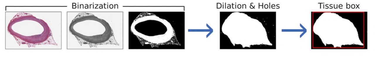 The tissue detection pipeline.The identification of the tissue bounding box is performed on the WSI thumbnail in three steps: a) Binarization of the grayscale image by applying Otsu’s thresholding; b) Binary dilation and filling of the holes; c) Selection of the biggest connected region as tissue region and computation of the vertex of the containing rectangle.