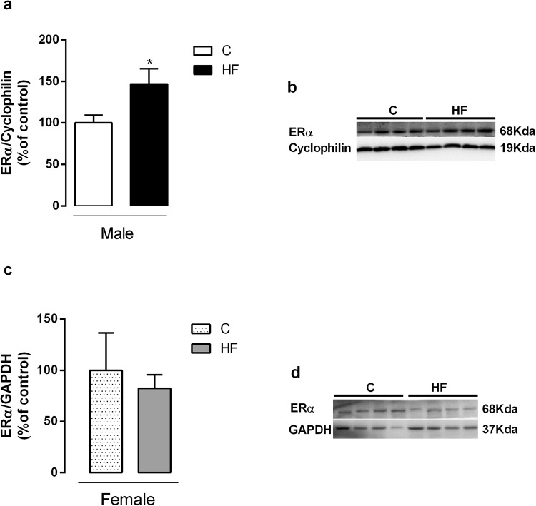 Effect of maternal HF diet on Estrogen receptor alpha (ERα) in liver in both male (a) and female (c) offspring at 180-day-old. Representative western blot bands for each protein were showed (b,d). Data is expressed as mean ± S.E.M, n = 7 per group, *p < 0.05, by Student’s t test.