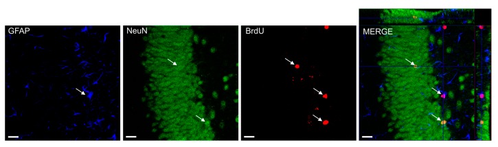 Bromodeoxyuridine (BrDU) positive cells in colocalization with NeuN and GFAP cells. The number of BrdU positive cells displaying astrocyte-specific (GFAP), neuron-specific (NeuN), BrDU-specific markers was determined using confocal microscopy to score the colocalization of BrdU and phenotypic indicators (MERGE-in orthogonal views) in representative sections from each animal. MERGE shows Z-axis projections of 23 μm × 1.32 μm. Bars: 20 μm.