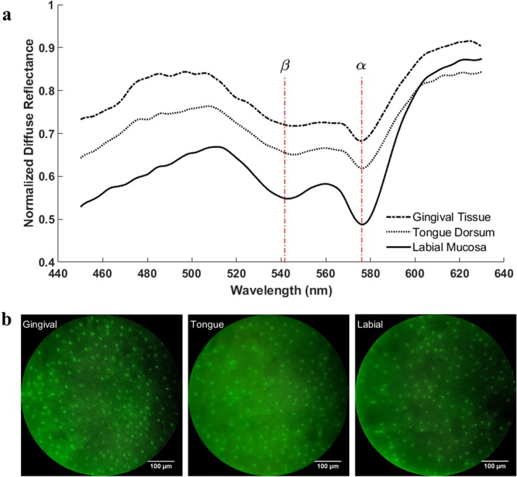 Measured tissue spectra and images from the normal gingival tissue, tongue dorsum tissue and labial mucosa tissue of a healthy subject in vivo. (a) Normalized representative diffuse reflectance spectra and (b) typical raw fluorescence images.