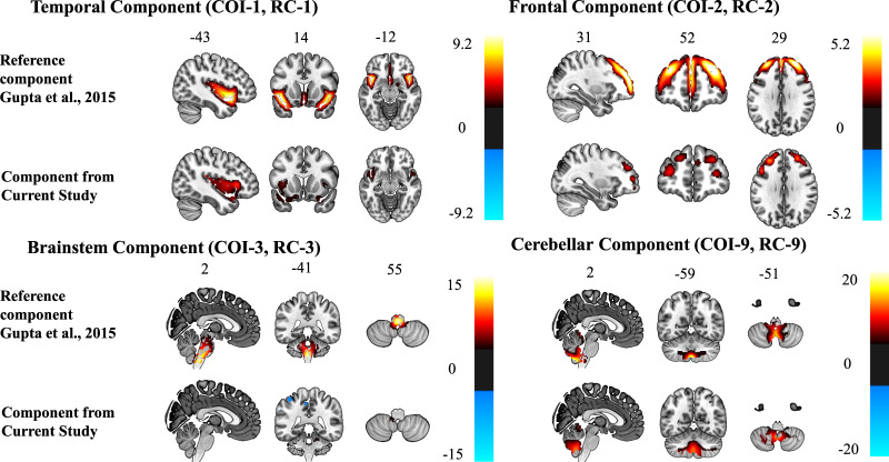 Cerebral mapping of the reference components and the four components from the current study, all thresholded at |z| > 2.5.The reference components are thresholded with the G-theory mask.