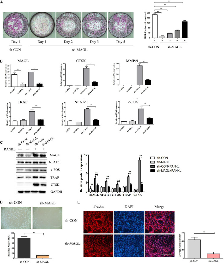 Knockdown of MAGL reduces osteoclast formation and bone resorption. BMMs were infected with adenovirus carrying MAGL-specific shRNA or a control adenovirus during osteoclast formation induced by M-CSF (30 ng/ml). (A) BMMs infected with control or sh-MAGL were stimulated with RANKL (75 ng/ml) and M-CSF (30 ng/ml) for the indicated times and analyzed for osteoclast formation. Representative images (left) and TRAP-positive cells (≥3 nuclei) were counted. Data are presented as means ± SD of three independent experiments. **P < 0.01 vs. day 0. (B) Control or sh-MAGL BMM cells were stimulated with RANKL (75 ng/ml) and M-CSF (30 ng/ml) for 3 days, and the expression of MAGL and osteoclast-specific genes was assessed by qPCR and (C) Western blotting. Data are presented as means ± SD of three independent experiments. **P < 0.01 vs. the control adenovirus. (D) Mature osteoclasts were seeded in Corning Osteo Assay strip wells and infected with control or sh-MAGL in the presence of RANKL (75 ng/ml) and M-CSF (30 ng/ml) for 3 days. Representative images of resorption pits are shown. (E) BMMs were infected with control or sh-MAGL and plated on bone slices in the presence of RANKL (75 ng/ml) and M-CSF (30 ng/ml) for 7 days. Representative F-actin images are shown. Data are presented as means ± SD of three independent experiments. **P < 0.01 vs. the control adenovirus.