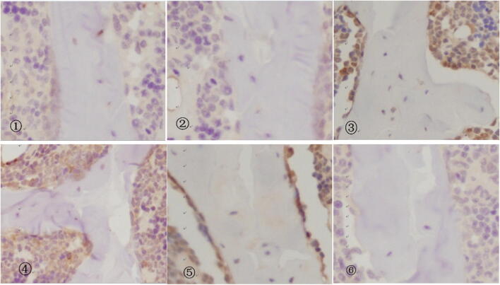 Immunohistochemistry results of bone tissue in each group (immunohistochemistry, × 400). ①, 4w NC group; ②, 6w NC group; ③, 4w IH group; ④, 4w IH + Ri group; ⑤, 6w IH group; ⑥, 6w IH + Ri group