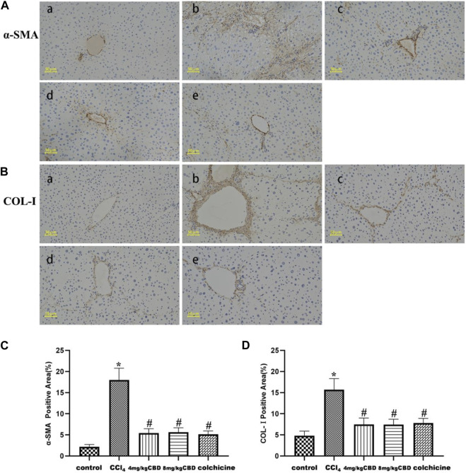 Effects of CBD on α-SMA and COL-Ⅰ in mice with CCl4-induced liver fibrosis. (A,B) Representative immunohistochemical staining of α-SMA and COL-Ⅰ. (C,D) Quantification of positive staining areas was performed by ImageJ software. The values represent the means ± SEM (n = 8). * p < 0.05 vs. the control group, # p < 0.05 vs. the CCl4 group, as determined by one-way ANOVA, followed by the LSD multiple comparisons test. (a) Control group; (b) CCl4 group; (c) 4 mg/kg CBD group; (d) 8 mg/kg CBD group; (e) 0.2 mg/kg colchicine group.