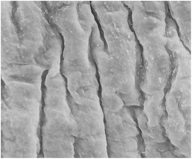 Loos of the endothelium from the luminal surface, longitudinal corrugations in the direction of blood flow caused by smooth muscle cells contractions in the tunica media.(Magnification- 520x).