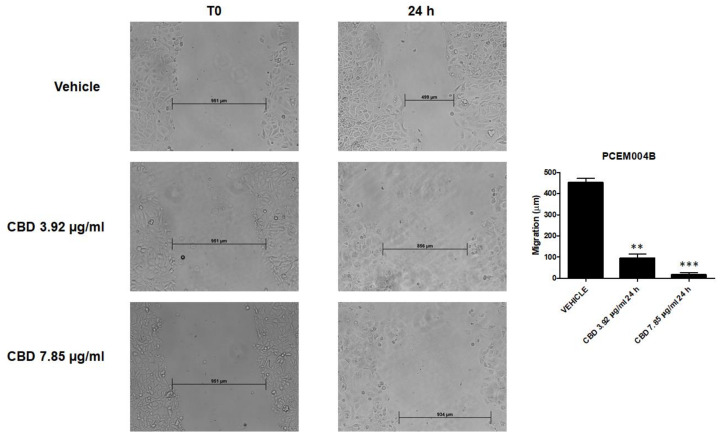 CBD treatment inhibited migration of PCEM004b cells. Wound-healing assays for PCEM004b cells after treatment with CBD 7.85 µg/mL and 3.92 µg/mL for 24 h. All experiments were repeated three times and images were taken at 0 and 24 h (20×). Data are presented as the mean ± SD. ** p < 0.01, *** p < 0.001 vs. untreated.