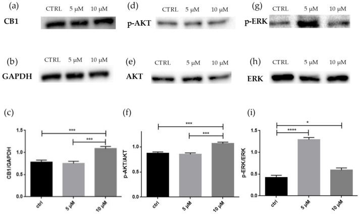 (a) Evidence of the significant increase of CB1 in NSC-34 after treatment with CBD at a high dose. (b) GAPDH used for normalization. (c) Densitometric analysis of CB1, *** p < 0.0005. (d) Evidence of phosphorylation of ATK at a high dose. (e) Non-phosphorylated AKT used for normalization. (f) Densitometric analysis of p-AKT, *** p < 0.0005. (g) Evidence of different phosphorylation of ERK at two doses compared to the control. (h) Non-phosphorylated ERK used for normalization. (i) Densitometric analysis of p-ERK, * p < 0.05, **** p < 0.0001.