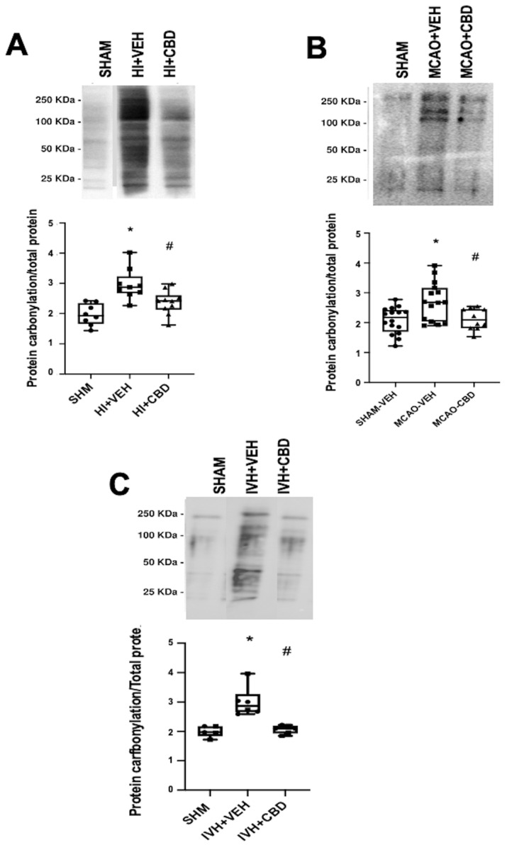 Representative Oxyblot films assessing protein carbonylation, and the corresponding graphical representation of the densitometric analysis, studied in brain samples obtained (A) 6 h after a hypoxic–ischemic (HI) insult (bilateral carotid artery occlusion plus exposure to FiO2 10% for 30 min) to 1- to 3-day-old piglets. (B) Seven days after stroke induction by reversible middle cerebral artery occlusion (MCAO) in 7- to 8-day-old Wistar rats; (C) five days after induction of intraventricular hemorrhage (IVH) by paraventricular injection of Chlostridium collagenase in 1-day-old rats. Injured animals were treated post insult with vehicle (VEH) or cannabidiol (CBD). Non-injured animals served as controls (SHAM). Boxes represent the median and interquartile range, and the whiskers are the maximum and minimum values. Dots represent individual data. (*) p < 0.05 vs. SHAM, (#) p < 0.05 vs. VEH, all analyzed by Kruskal–Wallis with Dunn’s test for multiple comparisons. The figures show the results from analyses carried out on data obtained from the studies described in references [20,21,22,29].