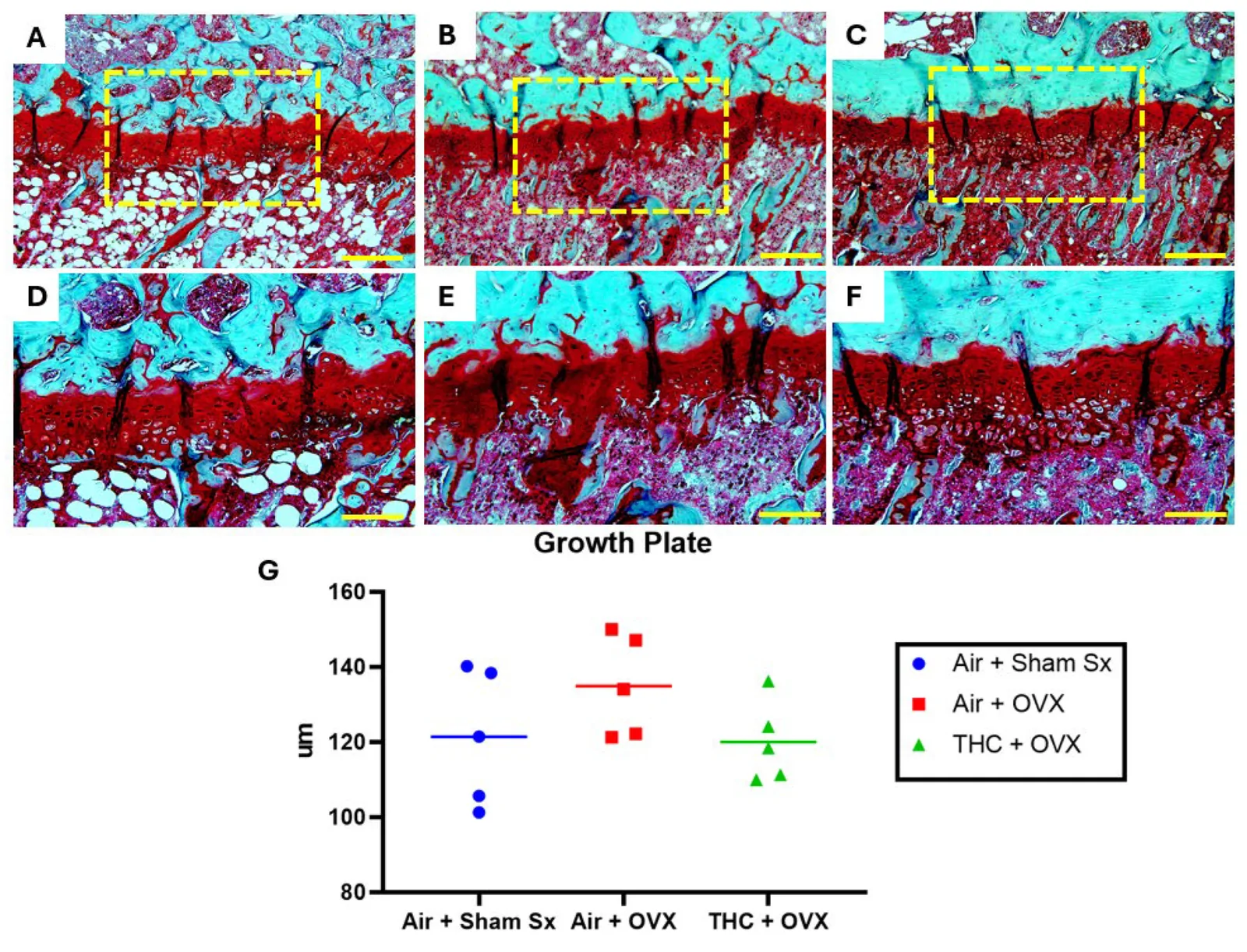 Growth plate histology. Photomicrographs of proximal tibial growth plates stained with Safranin O/Fast Green. (A) Air + Sham Sx; (B) Air + OVX; and (C) THC + OVX at low magnification (100×, scale bars = 200 µm) and (D) Air + Sham Sx; (E) Air + OVX; and (F) THC + OVX at high magnification (200×, scale bars = 100 µm, yellow dashed boxes). (G) Dot plots (mean-line) showing growth plate height for each group. Tukey’s multiple comparisons tests revealed these differences were not significant (Air + Sham Sx vs. Air + OVX; p = 0.3303) (Air + Sham Sx vs. THC + OVX; p = 0.9867).
