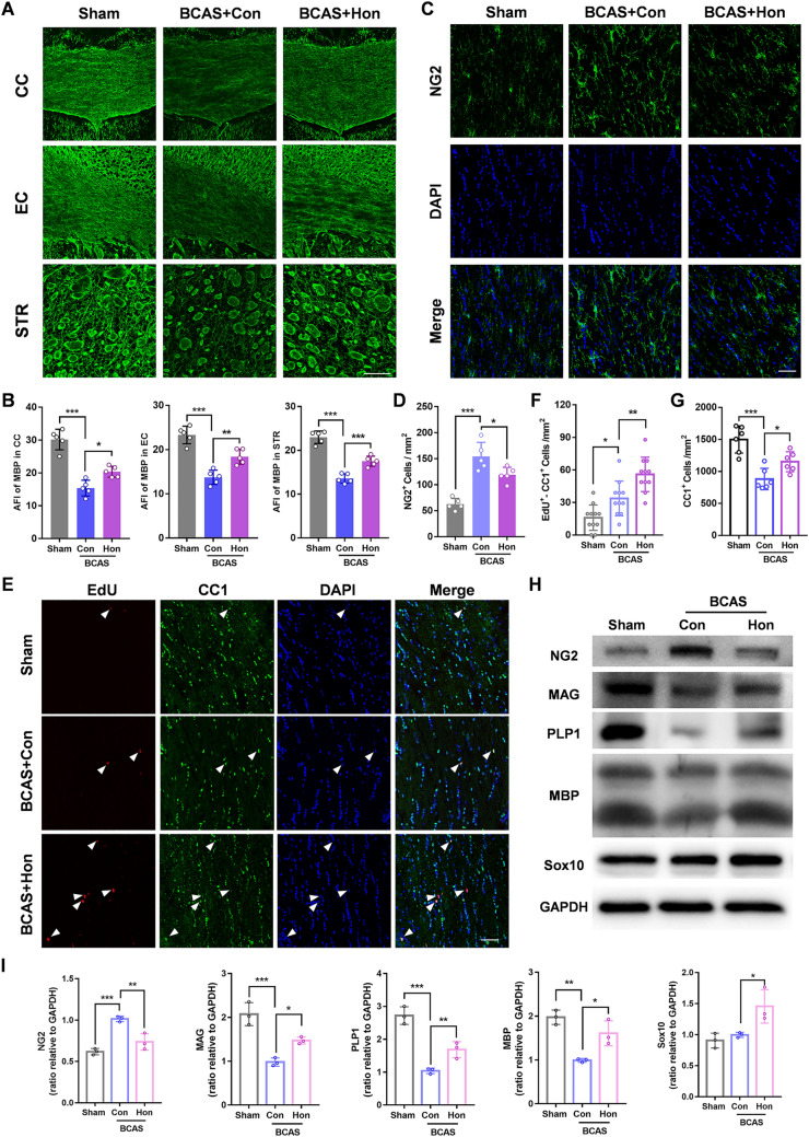 Honokiol promotes OL maturation and OPC differentiation in the BCAS model. A Immunofluorescence staining of MBP in the corpus callosum (CC), external capsule (EC), and striatum (STR) for each group 2 months after BCAS. Scale bar, 50 μm. B Average fluorescence intensity (AFI) of MBP staining in the CC, EC, and STR. C Immunofluorescence staining of NG2 to label OPCs in the CC 2 months after BCAS. Nuclei are stained with DAPI. Scale bar, 50 μm. D Numbers of NG2+ cells per mm2 as in C. E Newborn cells are marked by EdU (red) staining and nuclei of mature OLs are labeled by CC1 (green) and DAPI. The EdU+ and CC1+ cells were recorded in the CC for each group. Scale bar, 50 μm. White arrowheads indicate EdU+CC1+ cells. F, G Numbers of EdU+CC1+ cells and total CC1+ cells per mm2 as in E. H Western blots of the expression of NG2, MBP, MAG, PLP1, and Sox10 in the CC with GAPDH as a loading control. I Quantitative analysis of Western blots as in H. The results are presented as the mean ± SD. n = 3, *P <0.05, **P <0.01, ***P <0.001, one-way ANOVA.
