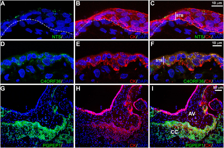 Immunolocalization of differentially expressed proteins: NTS, C4ORF36 and PGPEP1. Tissue sections were immunostained for the antigen of interest and cytokeratin (CK), a trophoblast marker. Nuclei were localized with DAPI. Each panel was a confocal z-stack maximum intensity projection. (A-C) Neurotensin (NTS) was detected in a vesicular pattern localized to the apical region of syncytiotrophoblasts (STB). Within any one tissue section the vesicle density varied among regions, although no areas lacked immunoreactivity. Furthermore, no differences based on gestational age were observed. (D-F) C4ORF36, which localized to STBs, had a uniformly dense punctate pattern. No variation was observed across the second trimester. (G-I) PGPEP1 was highly upregulated in cytotrophoblast columns (CC) of anchoring villi (AV). The results shown were represented of the immunostaining observed in a minimum of three biological replicates.