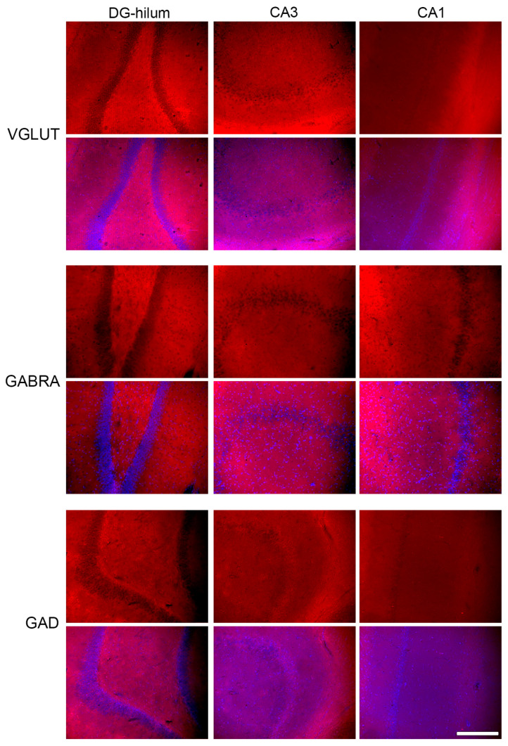 Representative photomicrographs of immunohistochemical staining of VGLUT, GABRA, and GAD in all three areas analyzed: DG-hilum, CA3, and CA1. Every upper line shows an image stained for the specific antibody, and the lower line shows a merge with the DAPI image in order to better identify the areas. Bar = 200 μm.