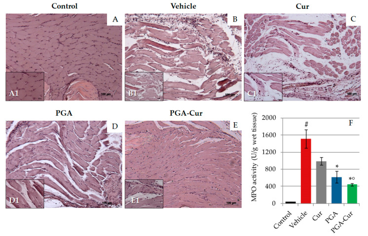 Anti-inflammatory effect of the study compounds in CAR-injected paw. Representative images of H/E-stained paw sections (A–E). Intraplantar injection of CAR-induced marked edema and cellular infiltration (B) compared to control animals (A). Histopathological changes appeared not to benefit from a single dose of curcumin (C), while PGA administration counteracted both tissue edema and cellular infiltration (D). The co-micronized formulation (single administration, 30 min prior to CAR) prevented almost completely the inflammatory changes (E). The histological findings mirrored the neutrophil infiltration into the paw as measured by myeloperoxidase (MPO) activity (F). Values are means ± standard error of the mean of 6 animals for each group. Cur = curcumin; PGA = micronized palmitoyl-glucosamine; PGA-Cur = co-micronized palmitoyl-glucosamine and curcumin. # p < 0.05 vs. control; * p < 0.05 vs. vehicle; ° p < 0.05 vs. Cur. The p values are reported in the text.