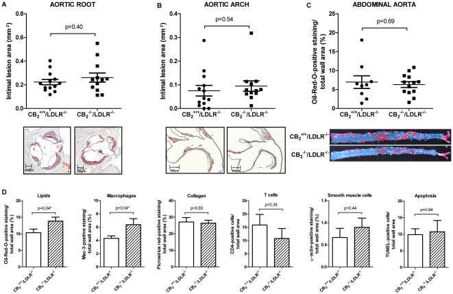 CB2 receptor deficiency does not influence atherosclerosis in mice.A and B, CB2 +/+/LDLR−/− (N = 13) and CB2 −/−/LDLR−/− (N = 12) mice consumed HCD for 16 weeks and underwent analysis of intimal lesion area in the aortic root (A) and arch (B). Pooled data ± SEM are shown on the left; representative images stained for lipid deposition (Oil-red-O) are displayed below the corresponding graph. C, The abdominal aortas of mice treated as described above underwent en face analysis of the lipid deposition. Oil-red-O-positive staining in relation to total wall area was quantified and is dispayed as pooled data ± SEM (N = 13 and 12); representative images are shown below. D, Sections of aortic roots of mice treated as described above were analyzed for lipid-, macrophage-, collagen-, T cell-, smooth muscle cell- and apoptotic cell content. Oil-red-O-, Mac-3-, picosirius red-, CD4-, α-actin- and TUNEL-positive staining in relation to total wall area is described as mean ± SEM (N = 13 and 12). Asterisks indicate a significant change, defined as p<0,05.