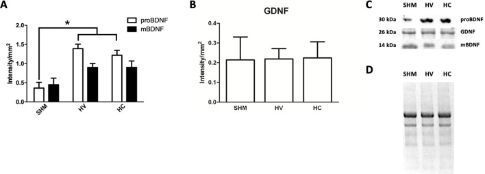 Determination of neuroproliferative factor expression. Western blot studies performed in the parieto-occipital cortex seven days after a hypoxic-ischemic (HI) insult induced in P7–10 Wistar rats then receiving vehicle (HV) or cannabidiol (HC), or a similar period in control rats (SHM). (A) Quantitative determination of the precursor (proBDNF) and mature (mBDNF) isoforms of brain-derived neurotrophic factor (BDNF) expression (B) Quantitative determination of glia-derived neurotrophic factor (GDNF) expression. Bars represent mean ± SEM. (C) Representative Western blot of proBDNF and mBDNF, GDNF. (D) Representative stain-free total protein image. *p < 0.05 vs SHM, by ANOVA.