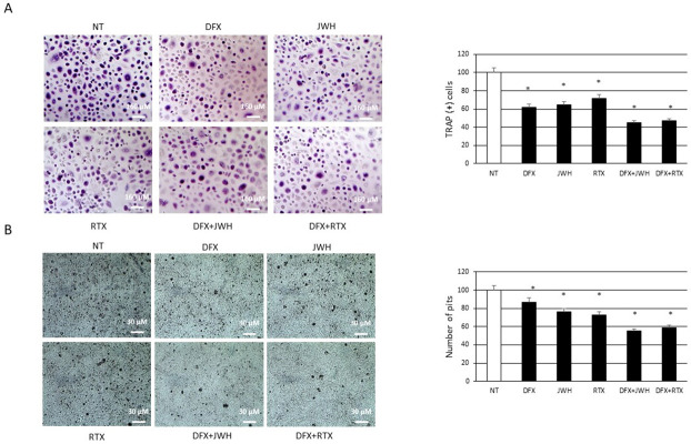 Effects of treatments on osteoclast number and activity.(A) TRAP assay on OCs, differentiated or not in presence of DFX [5μM], from 5 Childhood cancer survivors (CCS) after 48h of exposure with JWH-133 [100nM] and RTX [5μM]. The most representative images are showed (10x magnification). An AE2000 inverted microscope has been used to count TRAP (+) multinucleated (n ≥ 3) OCs (stained purple) in at least three different wells for each individual sample. Histogram shows the percentage number of TRAP (+) cells respect to the total cell number for each sample as mean ± SD. (B) Bone resorption assay on OCs, differentiated or not in presence of DFX [5μM], from 5 Childhood cancer survivors (CCS) after 48h of exposure with JWH-133 [100nM] and RTX [5μM]. The most representative images are displayed (10x magnification). An AE2000 inverted microscope has been used to count the pits (represented in the image as darker areas) on the plate in at least three different wells for each individual sample. Histogram shows the percentage number of pits as mean ± SD. For statistical analysis it has been used ANOVA test followed by a post hoc test. *Indicates p ≤ 0.05 compared to the untreated control (NT).