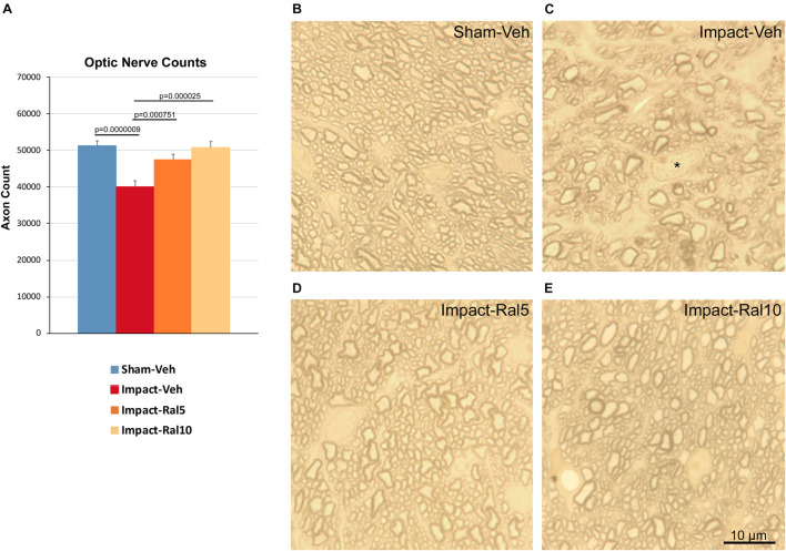 Optic nerve axon loss. (A) Impact-vehicle mice showed a significant 21.8% loss of optic nerve axons compared to sham mice. Treatment with 5 mg/kg raloxifene yielded partial rescue, with only a 7.4% reduction in optic nerve axons, such that axon abundance was significantly greater than for the impact-vehicle mice and only trended toward being significantly different from sham (p = 0.084). With raloxifene at 10 mg/kg, axon abundance was again significantly greater than in the impact-vehicle mice and indistinguishable from that in sham mice. Errors bars are SEMs. Animal numbers: 21 sham-vehicle mice, 25 impact-vehicle mice, 21 impact-ral5 mice, and 13 impact-ral10 mice. (B–E) High-magnification views of the optic nerve in sham-vehicle, impact-vehicle, impact-ral5, and impact-ral10 mice. The density of axons is obviously lower in the image from the impact-vehicle mouse, and glial cells occupy relatively more space than in the image from the sham mouse. The asterisk in C marks the nucleus of a glial cell. By contrast, axon density in the images from the impact-ral5 and impact-ral10 mice appears similar to that in the image from the sham mouse. Scale bar in (E) applies to (B–E).
