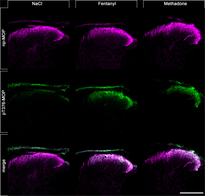 Double staining of agonist-induced p-MOP and np-MOP in mouse brain.Animals were either treated with NaCl (30 min), Fentanyl (15 min) or Methadone (30 min). Animals were then transcardially perfused, fixed and stained. Shown are confocal images of coronal sections of the spinal cord stained with phosphosite-specific antibody pT376-MOP (green) and phosphorylation independent np-MOP antibody (magenta). Note that there is a strong overlap of np-MOP and pT376-MOP in the merged panels (white) in agonist treated animals compared to NaCl treated mice. Scale bar = 250 µm.