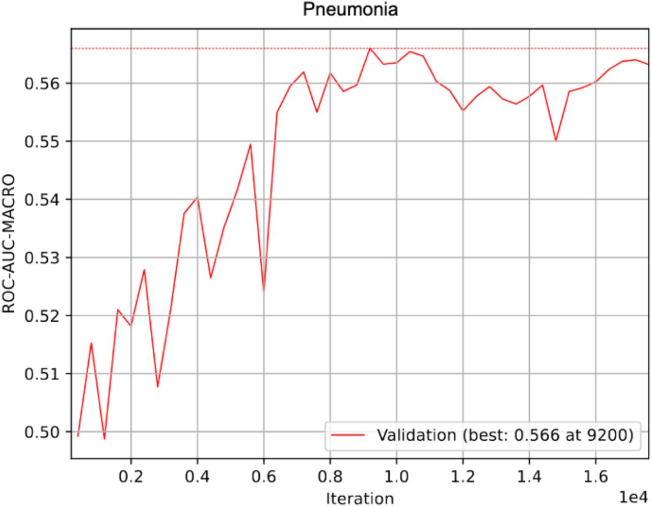 ROC-AUC development of the genetic GLN-model of bacterial pneumonia