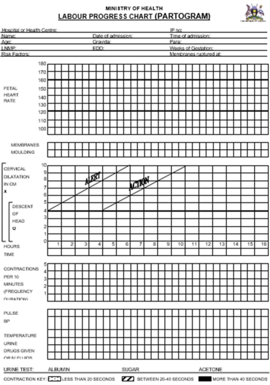 The Labour progress chart (Partogram)