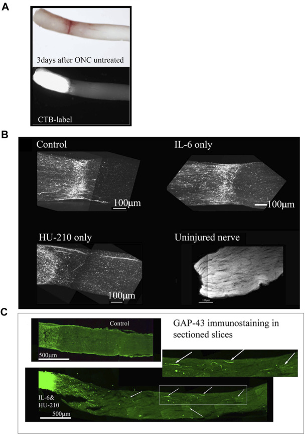 Individual drugs promote limited axonal regeneration. We visualized the whole nerve with CTB labelling using a Multiphoton microscope. (A) Control animals injected with 2.5 μL 0.5% DMSO, have few labeled axons crossing a short distance (less than 0.2 mm from the crush site), this was consistent for IL-6 (5 mg/mL) and HU-210 (300 μM) evaluated individually as well, where no significant axonal regeneration was detected past the crush site. Uninjured nerve with CTB labeling and 3-DISCO clearing shows the abundance of axons in the rat optic nerve. (B) Untreated crushed optic nerve was labeled with CTB immediately after injury and 3 days after crush we viewed the nerve under the light microscope (top image), and the CTB-label under fluorescence, showing no spared fibers (bottom image). (C) Fischer adult rats had unilateral ONC performed followed by intravitreal injections of either 0.5% DMSO for vehicle control (top) or the combination of IL-6 (5 mg/mL) and HU-210 (300 μM, bottom). Intravitreal injections were repeated on day 3 post-crush. After 3 weeks the nerves were removed, sectioned and immunolabeled with GAP-43. Controls had clear crush sites, but no GAP-43 labeled axons crossing the crush site, while IL-6 and HU-210 had regenerating axons nearly 3 mm away as indicated by arrows.