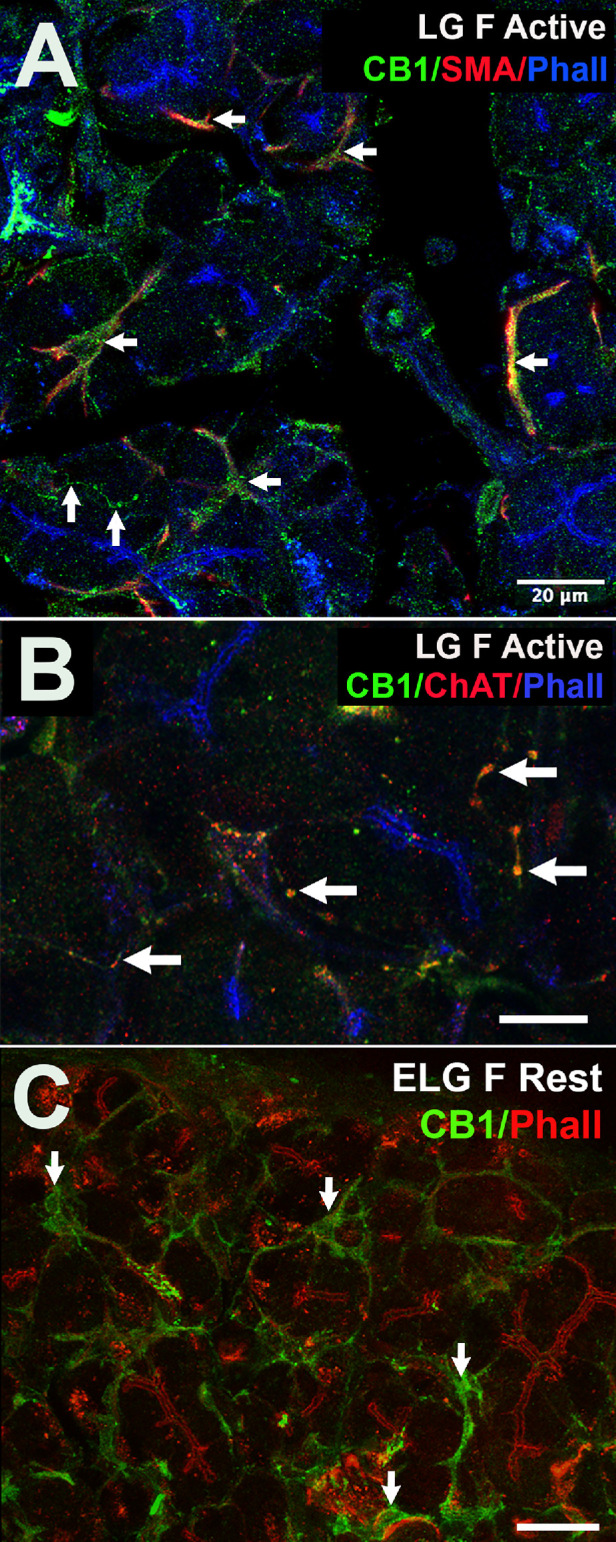CB1 protein in lacrimal gland of female mice is expressed in myoepithelial cells as well as parasympathetic inputs. (A) Lacrimal gland (LG) of female CD1 strain mouse during active phase shows CB1 (green) colocalizes with myoepithelial cell marker smooth muscle actin (SMA, red); overlap in yellow (left arrows). F actin marker phalloidin (Phall, blue) counterstains intra-acinar ducts. CB1-positive axon-like processes are also seen (upward arrows). (B) Axon-like CB1 colocalizes with parasympathetic marker ChAT (red, arrows). (C) CB1 staining in tissue from female rest phase lacrimal gland shows similar staining pattern, including myoepithelial cells (arrows). Phalloidin counterstain in red. Scale bars: (A) 20 µm, (B) 10 µm, and (C) 25 µm.