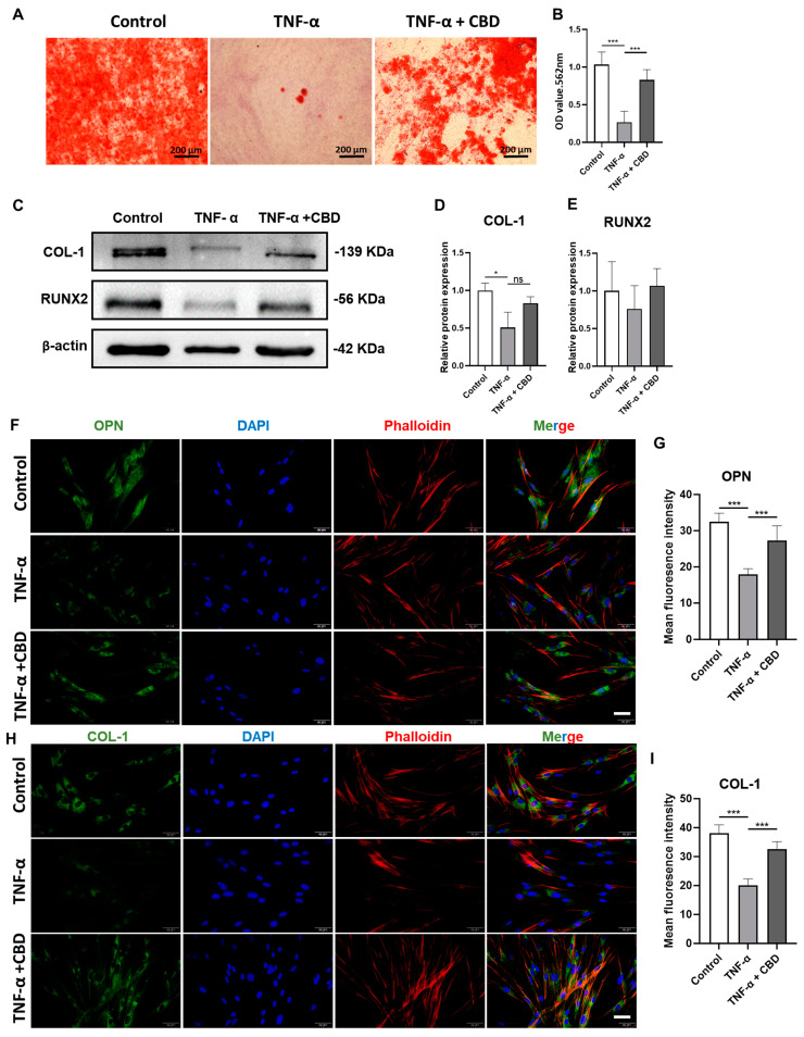 CBD rescues TNF-α-inhibited osteogenic/odontogenic differentiation of DPSCs. (A) Alizarin red staining of DPSCs culture at day 28. (B) Quantification of the mineralized matrix from alizarin red staining. Scale bar: 2 mm. (C) Western blot analysis for COL−I and RUNX2 at day 7. Quantification of COL−I (D) and RUNX2 (E) expression from Western blots. Immunohistochemistry analysis quantification of OPN (F,G) and COL−I (H,I) expression in DPSCs. Scale bar: 50 μm. Significant effect of the treatment compared to the control group, * p < 0.05, *** p < 0.001.
