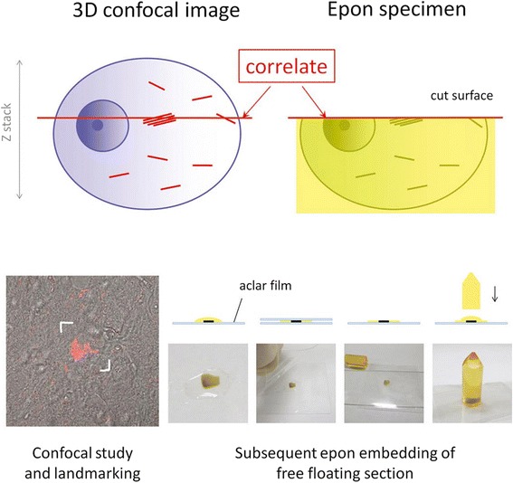 Outline of correlation of confocal and EM images. Three-dimensional (3D) reconstructed confocal data of the pretangles were obtained from a free-floating section. After landmarks were punched out around the target neuron using laser microdissection, sections were fixed and embedded in epon: the section was gently pressed between aclar films, hardened, then stuck to the columnar epon prepared in advance. The epon block was trimmed by the guidance of landmarks around the neuron, and ultrathin section of the block were examined with electron microscopy (EM). After obtaining the most appropriate EM images, their exact light microscopic counterparts were retrieved from the corresponding fluoresent 3D data set for direct comparison.