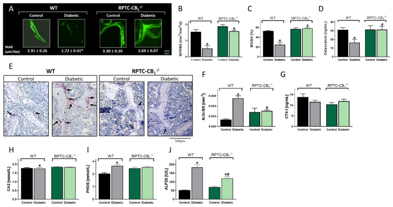 Nullification of CB1R in RPTCs prevents diabetes-induced inhibition of bone formation and upregulation in osteoclastogenesis. Representative images of calcein-labeled mineralized fronts with mineral apposition rate (MAR) values (A). Bone formation rate (BFR/BS; B), mineralizing surface (MS/BS; C), and osteocalcin serum levels (D). Images of TRAP+ osteoclasts (E), the number of osteoclasts per trabecular surface area (N.Oc/BS; F), and the serum levels of CTX-1 (G). The levels of the circulating biochemical markers, calcium (CA2; H), phosphate (PHOS; I), and alkaline phosphatase (ALP2S; J). Data represent the mean ± SEM from 8–13 animals per group, * p < 0.05 vs. non-diabetic WT control mice, # p < 0.05 vs. diabetic WT mice.