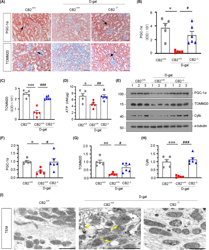 CB2 deficiency protects renal mitochondrial homeostasis in the accelerated ageing mice. (A) Representative micrographs showing renal expression of PGC‐1α and TOMM20 in different groups. Paraffin‐embedded kidney sections were immunostained with an antibody against PGC‐1α or TOMM20. Arrows indicate positive staining. Scale bar, 50 μm. (B‐C) Quantitative data showing quantification of positive staining. *p < 0.05, ***p < 0.001 versus WT mice group alone; # p < 0.05, ### p < 0.001 versus the d‐gal‐treated WT mice group alone (n = 5–6). (D) Representative graph showing the production of adenosine triphosphate (ATP) in different groups. *p < 0.05 versus WT mice group alone; ## p < 0.01 versus the d‐gal‐treated WT mice group alone (n = 5–6). (E–H) Representative Western blot and quantitative data showing renal expression of PGC‐1α, TOMM20 and Cytb. Numbers (1–3) indicate each individual animal in a given group. *p < 0.05, **p < 0.01, ***p < 0.001 versus the WT mice group alone; # p < 0.05, ### p < 0.001 versus the d‐gal‐treated WT mice group alone (n = 5–6). (I) Representative transmission electron microscopy graphs showing mitochondrial ultrastructure of renal tubular cells in different groups. Arrows indicate damaged and abnormal‐shaped mitochondria. Scale bar, 1μm