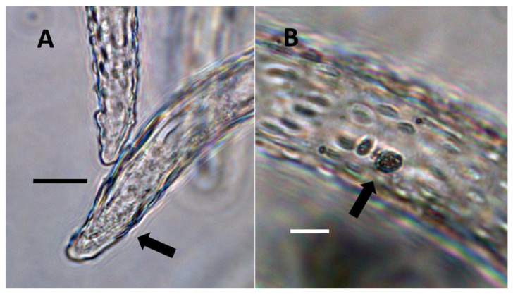 Pitted trichome of Ailanthus altissima showing bacteria. (A) Developing trichome stained with acidified diphenylamine showing nitrate (blue color) around bacteria (arrow) in the tip of the trichome (Bar = 10 µm). (B) Trichome stained with sulfur monochloride to show bacteria (arrow) emerging from lateral pits in wall (Bar = 10 µm).