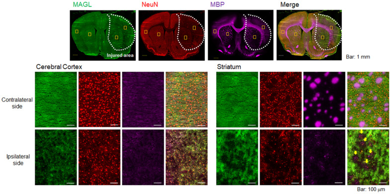 Immunofluorescence staining of rat brain sections on day 2 after MCAO surgery. Representative immunofluorescence images in the whole hemisphere (×4 magnification) are shown for MAGL (A; green), NeuN (B; red), and MBP (C; pink). D shows merged images of A-C. All images (A-D) on the top include yellow squares indicating the positions of the four close-ups. E-H: Close-up images (×20) for MAGL, NeuN, MBP, and merged stains in the cortex area of the contralateral hemisphere. I-L: Close-up images of the striatum area in the contralateral hemisphere. M-P: Close-up images of the cortex area in the ipsilateral hemisphere. Q-T: Close-up images of the striatum area in the ipsilateral hemisphere. Scale bar: 1 mm in the top images (A-D) and 50 μm in the middle and bottom images (E-T). Yellow arrows indicate a remarkable decline in MAGL signals overlapping with decreased MBP signals (T).