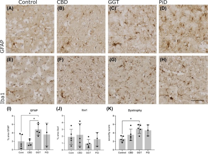Glial cell activation in control and tauopathy. (A)–(D), Astrocytes were stained with anti‐GFAP in control, CBD, GGT, and PiD cases. (I) Quantification of % area GFAP immunoreactivity showed a significant increase in GGT compared to control cases (p = 0.0317). (E)–(H), Microglia were stained with Iba1 in control, CBD, GGT, and PiD. (J), quantification of % area Iba1 immunoreactivity did not show any significant differences in Iba1 levels. (K) Semi‐quantitative analysis of microglia dystrophy (E)–(H) showed a significant increase in severity in GGT cases compared to controls (p = 0.013). Control, n = 5; CBD, n = 5; GGT, n = 5; and PiD, n = 3. Error bars = mean ± SD. Scale bar = 100 μm.