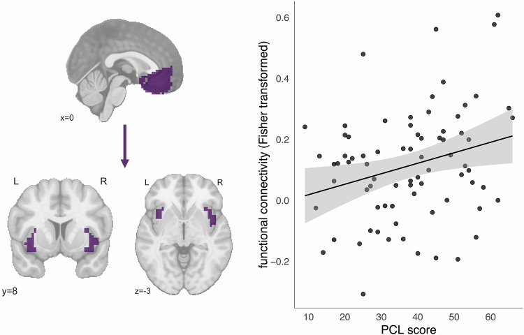 vmPFC-anterior insula connectivity is positively associated with self-reported PTSD symptoms.Functional connectivity units (on the y-axis) are Fisher-transformed correlations. Scatterplot trend line added for visualization purposes.