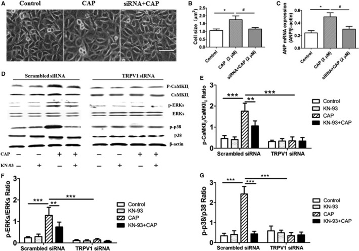 Expression of CaMKII δ‐dependent mitogen‐activated protein kinase signaling in TRPV1 siRNA–treated H9C2 cells. A, Morphologies of H9C2 cells were examined after CAP treatment on control or TRPV1 siRNA–treated groups for 48 hours. Scale bar=25 μm. B, Cardiomyocyte cross‐sectional area was measured after CAP treatment. C, Representative mRNA products of ANP in the CAP‐treated H9C2 cells (5 independent experiments per group) are shown. *P<0.05 versus control, # P<0.05 versus 2 μmol/L CAP. D, In scrambled siRNA– and TRPV1 siRNA–treated cells, 1 μmol/L CaMKII δ inhibitor KN‐93, 2 μmol/L CAP, or 1 μmol/L KN‐93 plus 2 μmol/L CAP were added in culture media for 48 hours, and then cell extracts were analyzed by Western blotting for CaMKII δ, ERKs, and p38 protein; β‐actin was used as internal control. Relative expression ratios of p‐CaMKII δ to CaMKII δ (E), p‐ERKs to ERKs (F), and p‐p38 to p38 (G) in cells with different treatment (5 independent experiments per group) are shown. **P<0.01, ***P<0.001. ANP indicates atrial natriuretic peptide; CaMKII, calmodulin‐dependent protein kinase II; CAP, capsaicin; ERK, extracellular signal–regulated kinase; p, phosphorylated; siRNA, small interfering RNA.