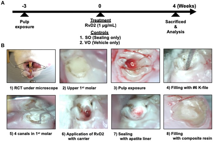 Experimental protocol of rat periapical periodontitis model. (A) Root canal treatment was performed 3 weeks after pulp exposure and rats were sacrificed and evaluated 4 weeks after treatment. (B) Cavity preparations of first molar, root canal treatment, and final restoration under microscope guidance.