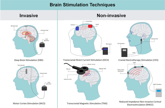 Graphical presentation of available brain stimulation techniques. Parts of the figure were drawn using pictures from Servier Medical Art. Servier Medical Art by Servier is licensed under a Creative Commons Attribution 3.0 Unported License (https://creativecommons.org/licenses/by/3.0/)