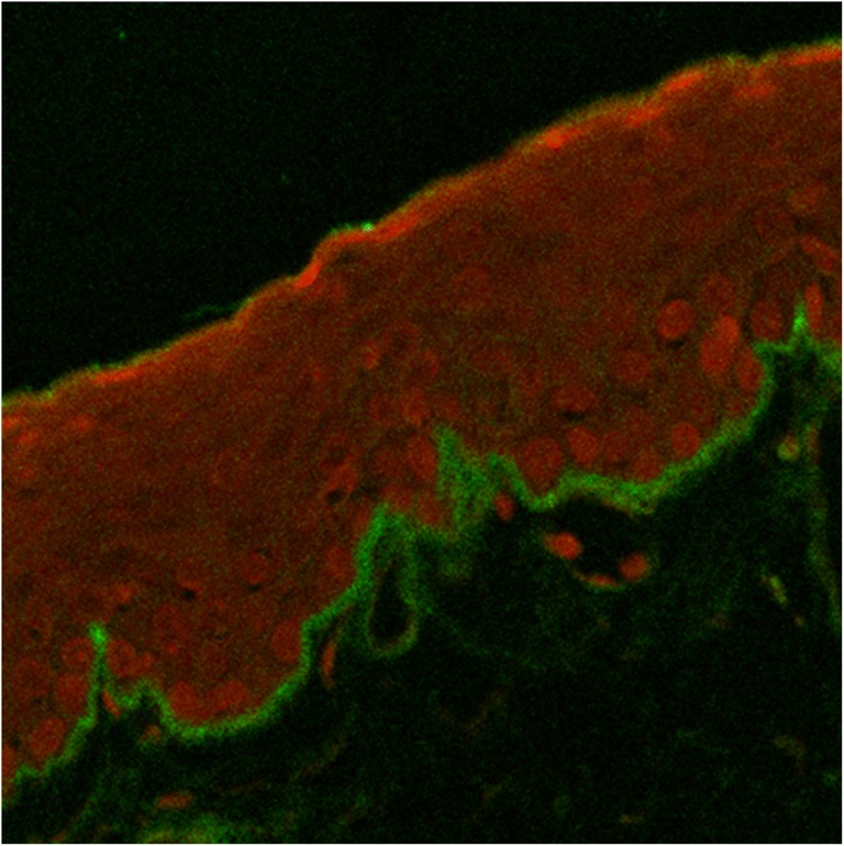 Confocal analysis of ocular cicatricial pemphigoid diagnosis by polyvalent IgG. Direct immune fluorescence IgG/propidium iodide, merge, × 20